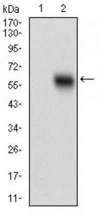 EPCAM Primary Antibody  MP30630T [M7B5C10]