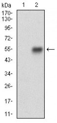 CNN1 Primary Antibody MP30636T [M1H5B5]