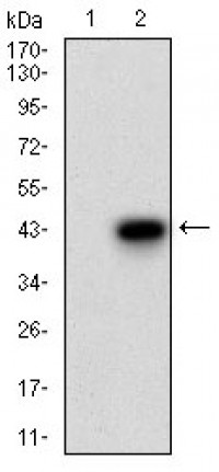 FSHB Primary Antibody MP30640T [M3C1E4]