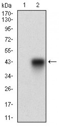 B3GALT4 Primary Antibody MP30642T [M5F12B8]