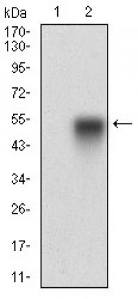 CAV2 Primary Antibody MP30645T [M5E9E2]