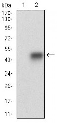 SMCP Primary Antibody MP30646T [M5C10D8]