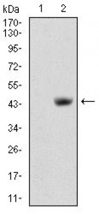 MB Primary Antibody MP30651T [M6B9D2]