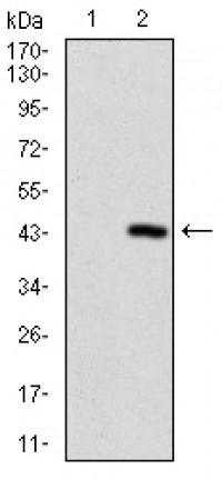 PRL Primary Antibody MP30657T [M2H10B2]