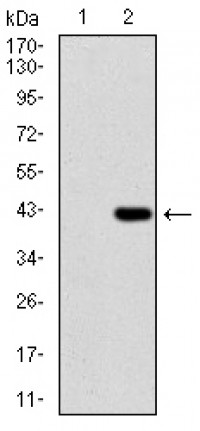 SDC1 Primary Antibody MP30658T [M1A3A3]