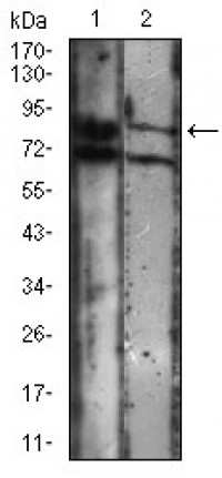 CDH16 Primary Antibody MP30659 [M6H6E2]