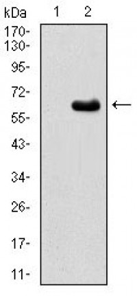 EIF2AK2 Primary Antibody MP30664T  [M3A10F7]
