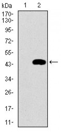 CCNE1 Primary Antibody MP30666T [M5F8B4]