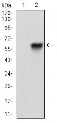 RANBP9 Primary Antibody  MP30670T [M6E10H5]