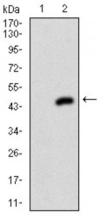 MEN1 Primary Antibody MP30671T [M7D3E10]