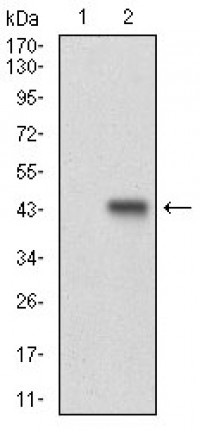 CCNE1 Primary Antibody MP30675T [M5F8C5]