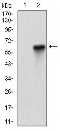 EIF2AK2 Primary Antibody  MP30680T [M6H3A10]