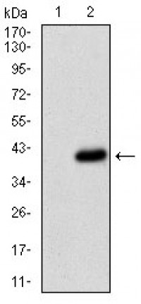 CD36 Primary Antibody MP30683T [M5B6B2]