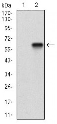 CD200 Primary Antibody MP30688T [M6E8B11]