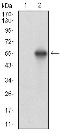 CSNK2B Primary Antibody MP30691T [M2F12F3]