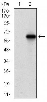 VIL1 Primary Antibody MP30692 [M5E3B2]