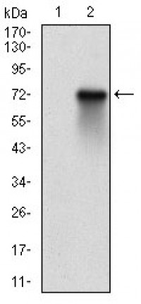 RPS6KA2 Primary Antibody MP30694T [M3C4C8]