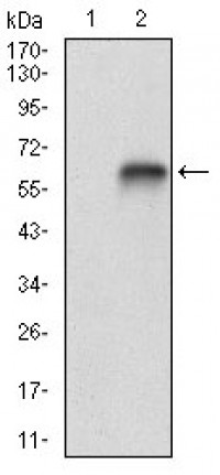 VTN Primary Antibody MP30697T [M1G11E8]