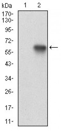XRCC6 Primary Antibody MP30698T [M7A9E7]