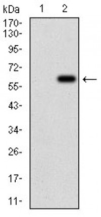 VIL1 Primary Antibody MP30700T [M3E5G11]