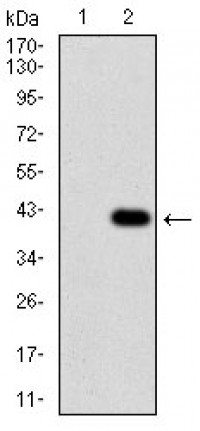 CD36 Primary Antibody MP30701T [M5B6F5]