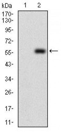PDK2 Primary Antibody  MP30710T [M3F2D7]