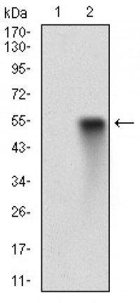 CCNA2 Primary Antibody MP30714T [M6B4D11]