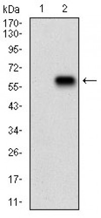 PKN1 Primary Antibody MP30717T [M4H10B1]