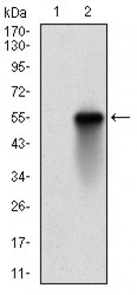 CSNK2B Primary Antibody  MP30718T [M1H8A5]