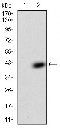 TFF2 Primary Antibody  MP30731T [M4G7C3]