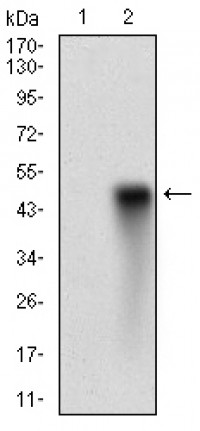 HDAC10 Primary Antibody  MP30734T [M3B6B8]