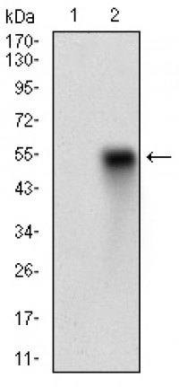 CD38 Primary Antibody MP30735T [M5C5C3]