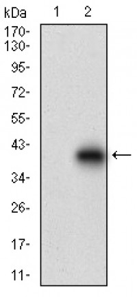 CDH17 Primary Antibody MP30737T  [M7D10E1]