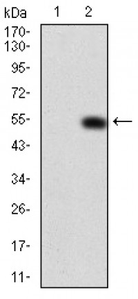 PDGFRA Primary Antibody  MP30745T[M8E12D1]