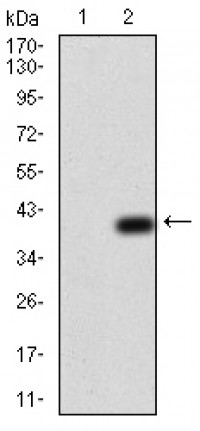 NOX4 Primary Antibody MP30754T  [M3H2G11]