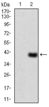 WTAP Primary Antibody  MP30758T [M6B6B8]
