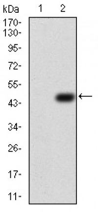 TUBB1 Primary Antibody MP30762 [M2A1A9]