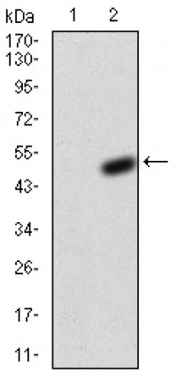 KCND2 Primary Antibody MP30764T  [M5B11B9]