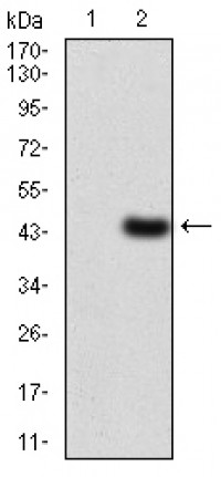 LDLR Primary Antibody  MP30767T [M1B10H10]