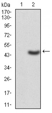 LDLR Primary Antibody  MP30772T [M7H5B11]