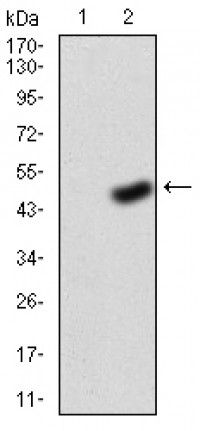 FGFR3 Primary Antibody MP30777T [M2H10B4]