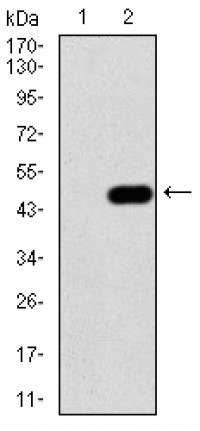 IRAK3 Primary Antibody MP30786T [M5C3D6]