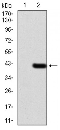 WTAP Primary Antibody MP30788T  [M6B6B6]