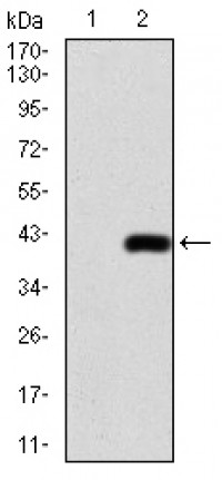 TFAP2A Primary Antibody MP30791T [M7D2B5]