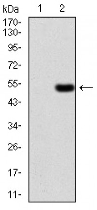 EZR Primary Antibody MP30799T [M6F1A9]