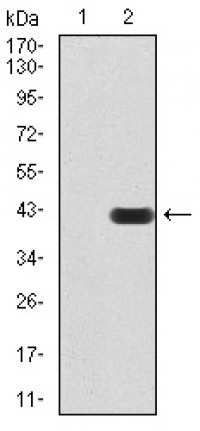PMS2 Primary Antibody MP30863 [M1E9D11]