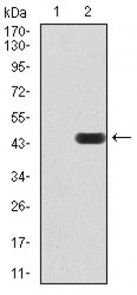MMP14 Primary Antibody MP30869 [M6A11D1]