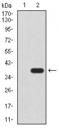 CK5 Primary Antibody MP30892 [M3D6D4]