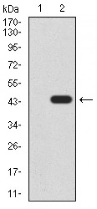 KDM4A Primary Antibody MP30903 [M6E10G4]