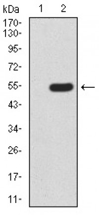 MECP2 Primary Antibody MP30905 [M8H4A5B9]